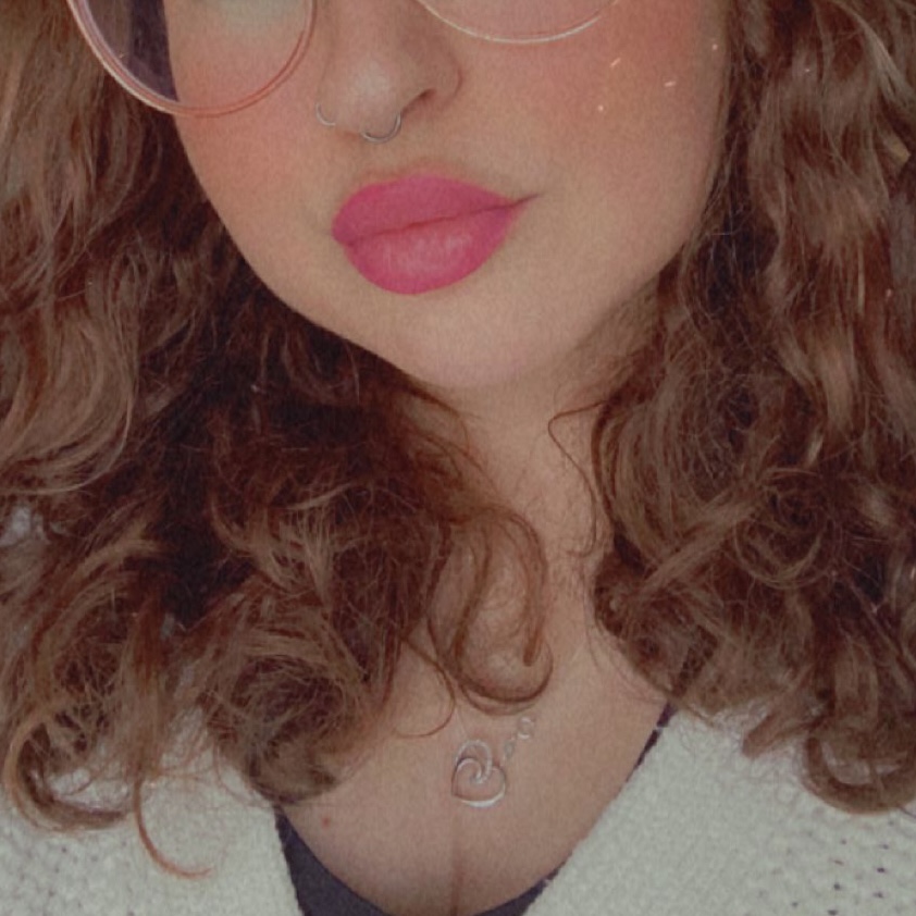 Rebekah Russell's lips after her treatments with Alice